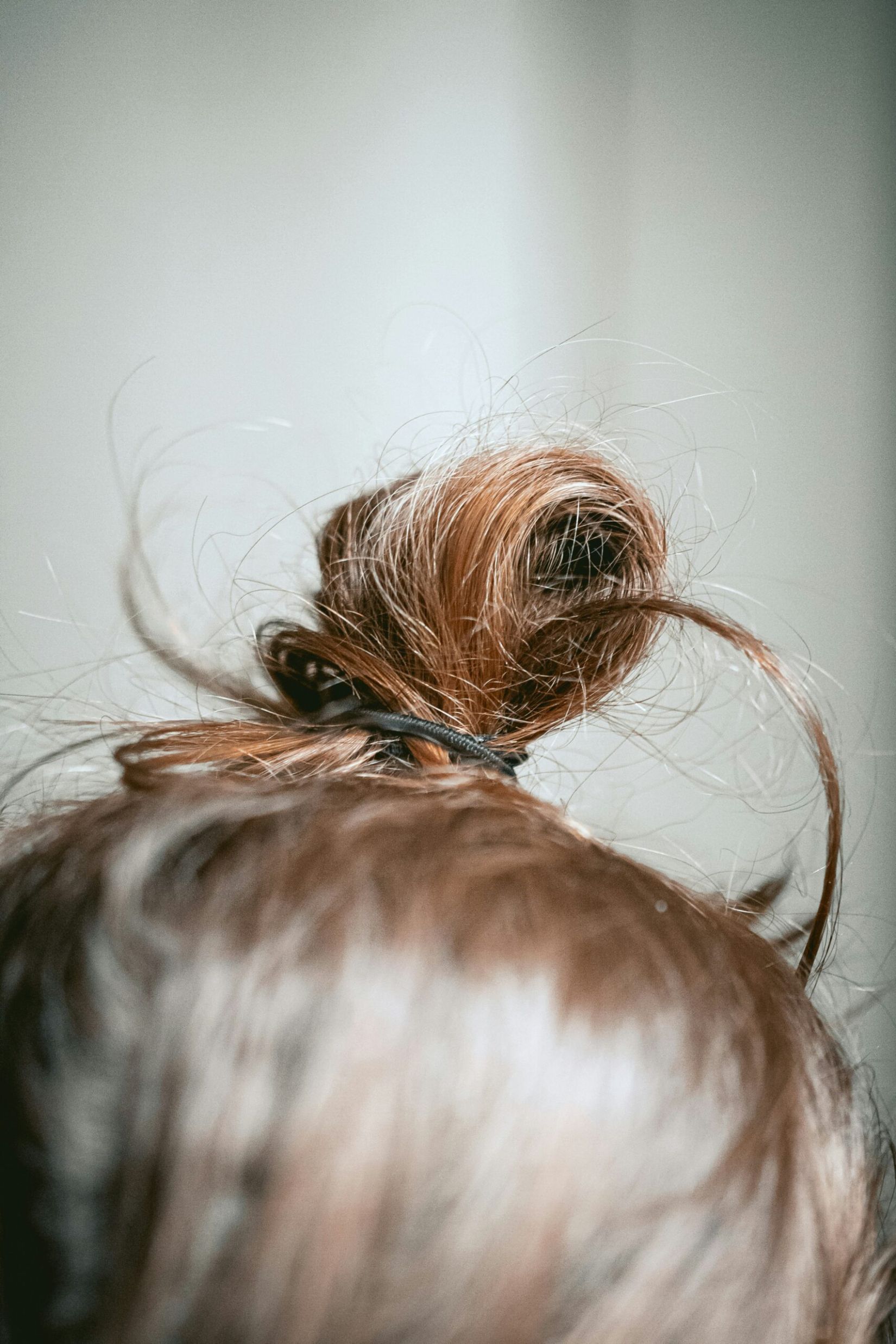 Exosomen Hautregeneration