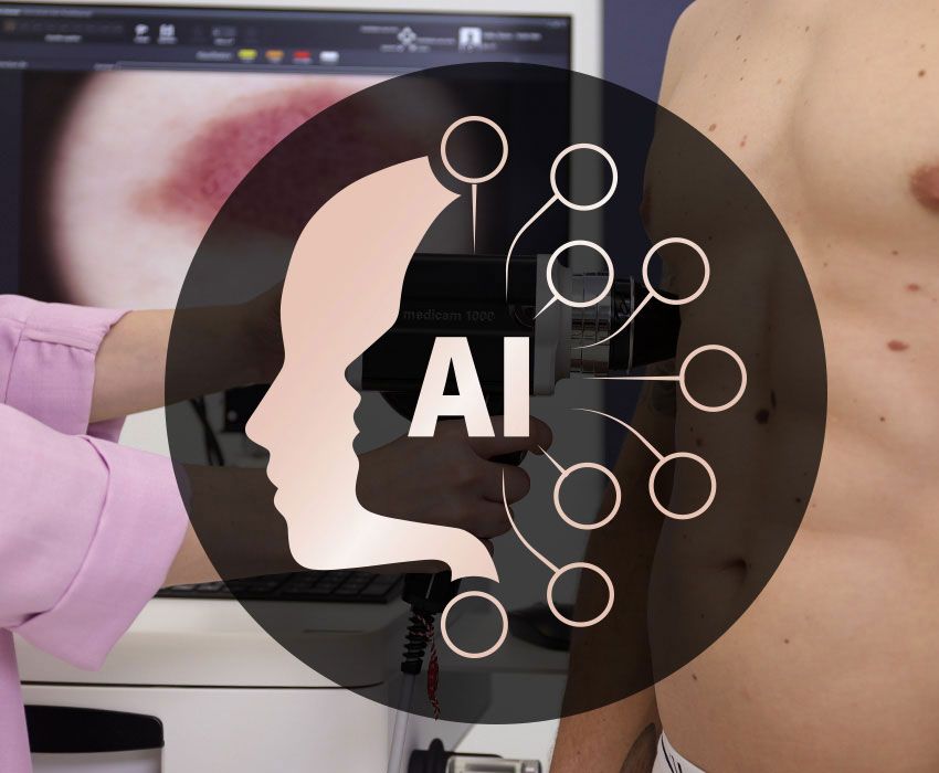 FotoFinder KI Muttermalkontrolle